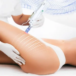 Sesión dermapen corporal